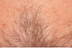 Hairy Skins